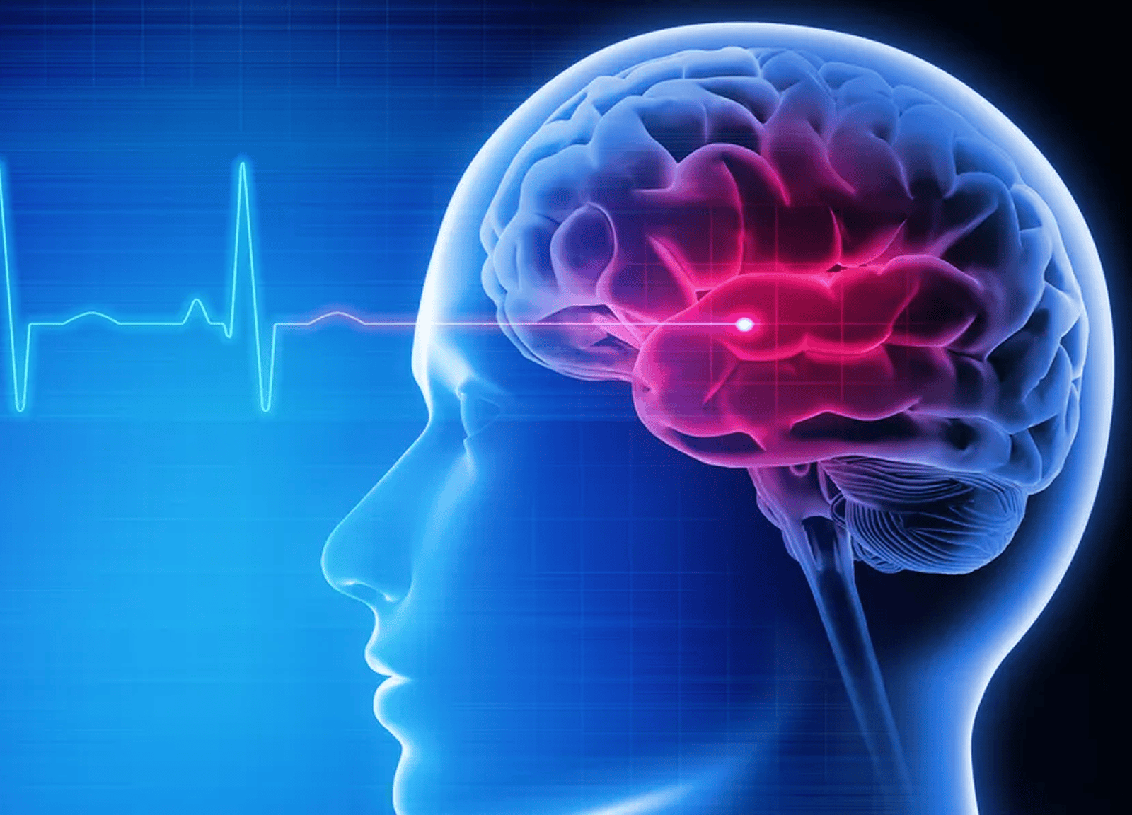 Brain of a Human